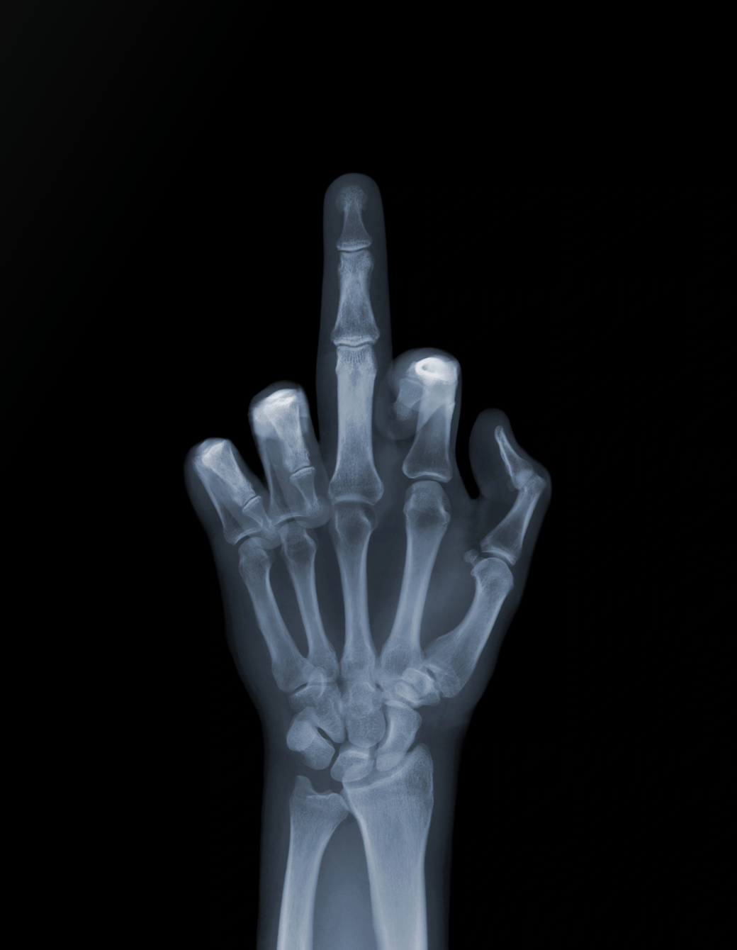 Nick Veasey - The Finger, 2001, Framed Chromaluxe 