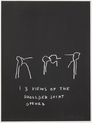 Jean-Michel Basquiat - Three Views of The Shoulder Joint Opened, from Anatomy